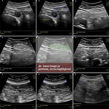 Ultrasound Sample Images